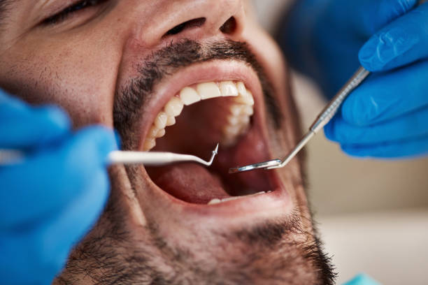 Best Emergency Dental Care for Broken or Chipped Teeth in Dayton, NJ